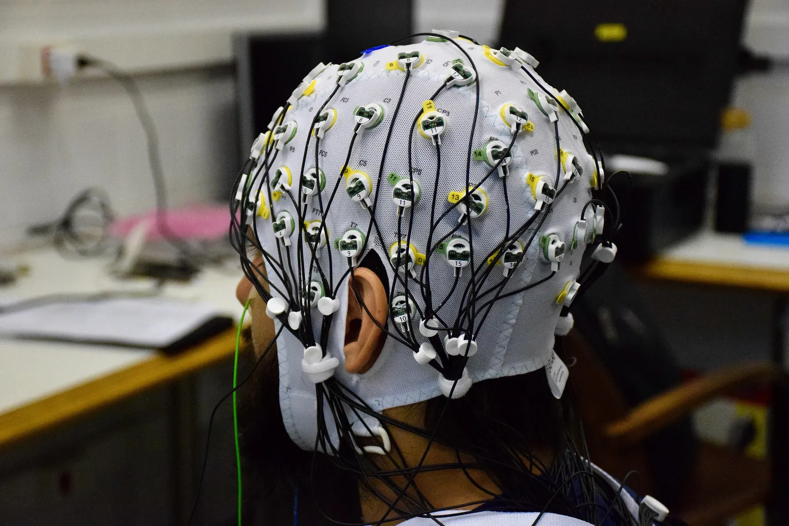 A head seen from three-quarters behind, wearing a white cap covered in electrodes connected by black wires