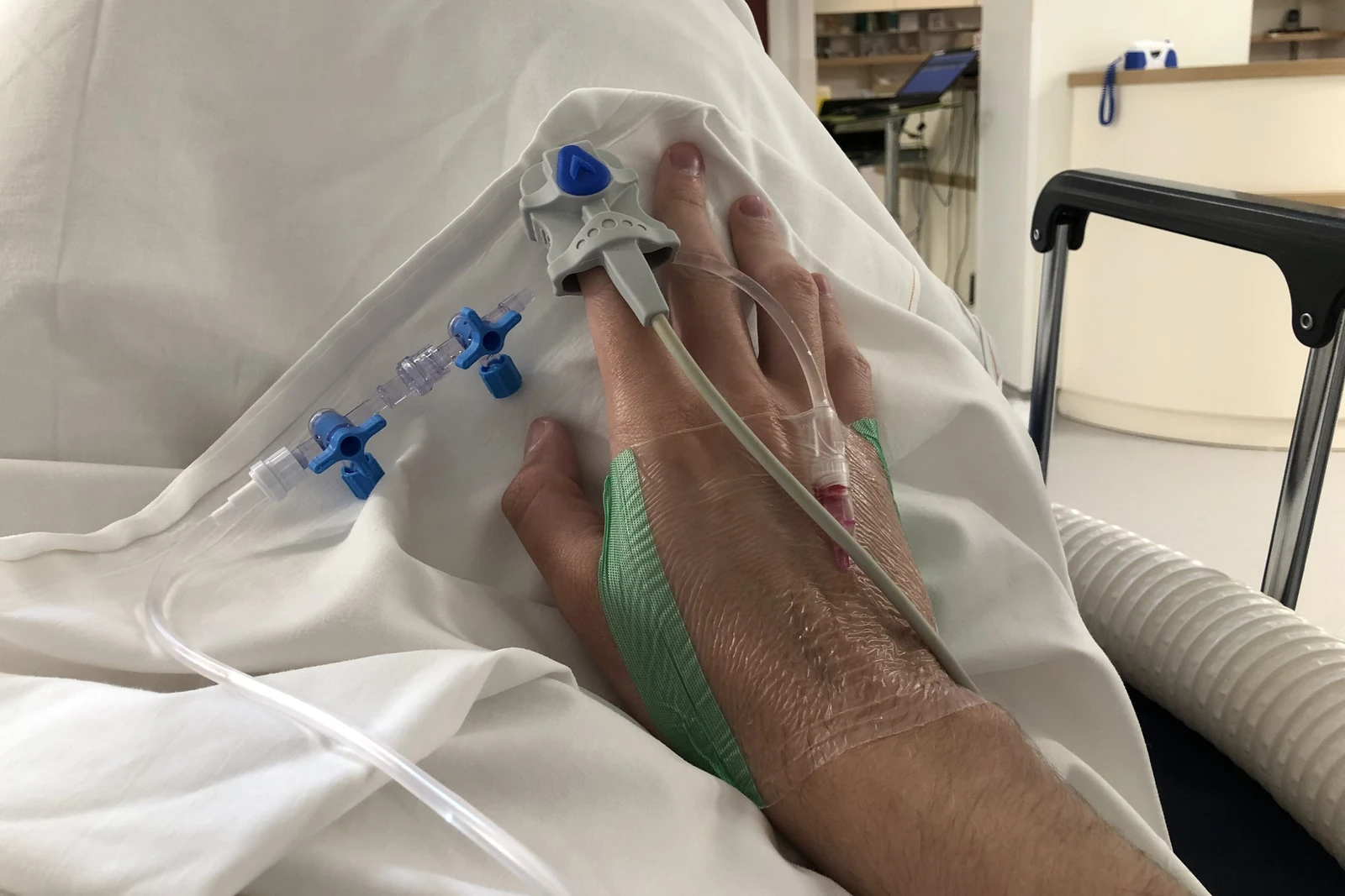 Hand of a patient lying down, with a catheter fixed on the back of the hand and connected to an infusion line by blue stopcocks